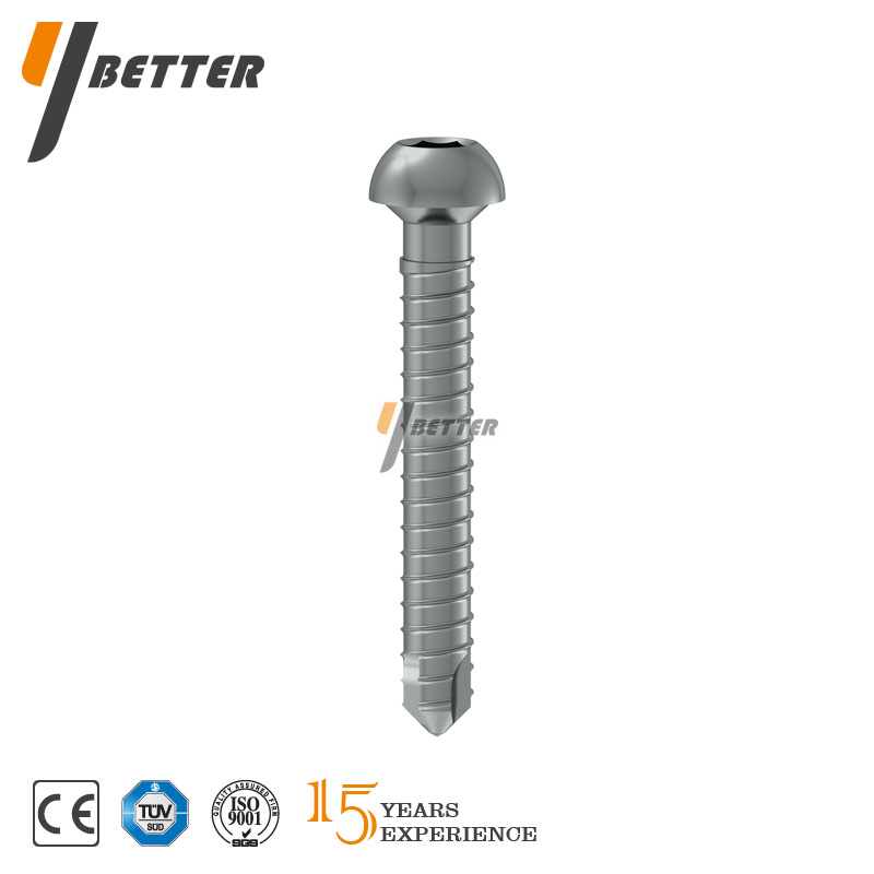 鎖定型脛骨髓內釘 (遠端鎖釘）