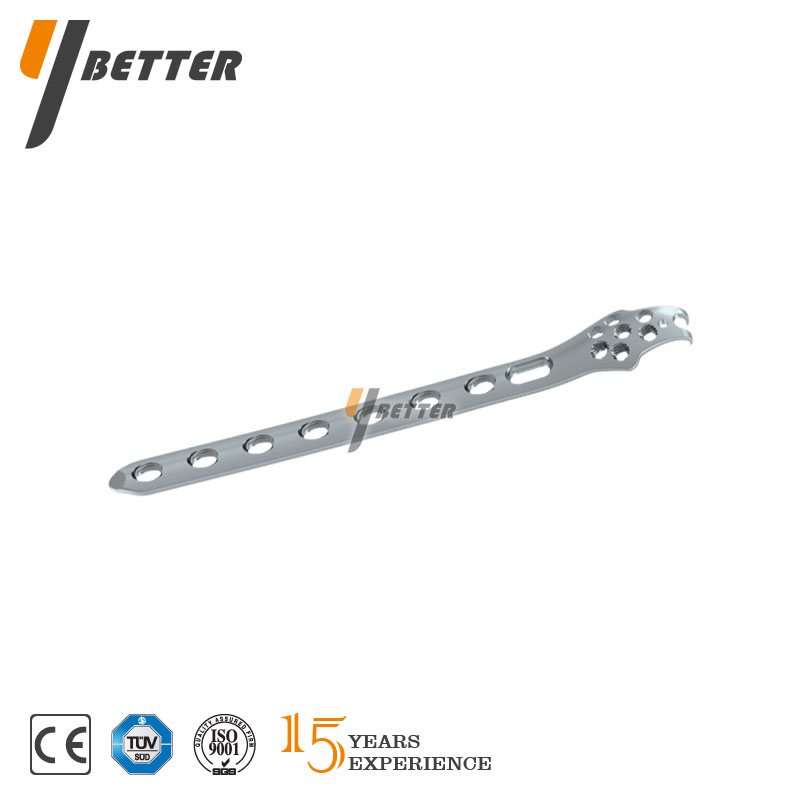 腓骨遠端外側鉤型鎖定板