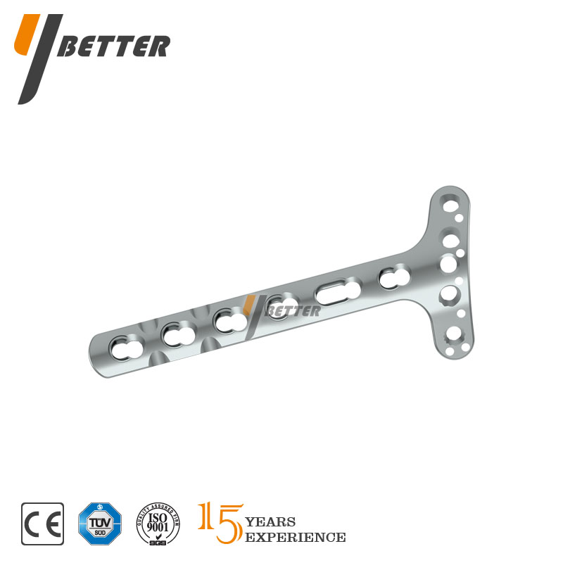 橈骨遠端背側鎖定板（低切跡）