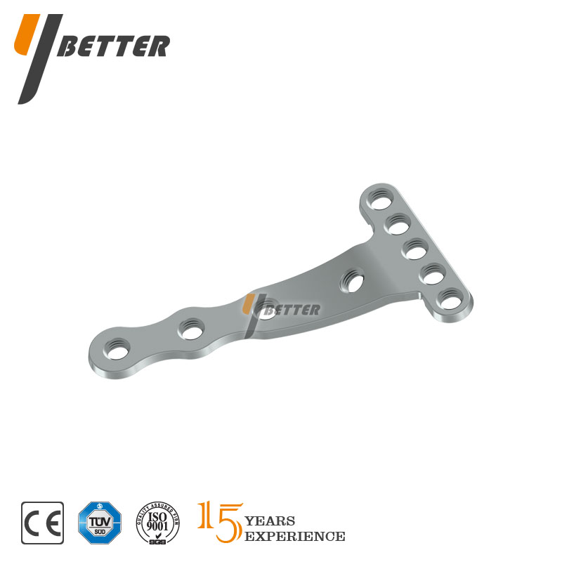 橈骨遠端掌側斜T形鎖定板