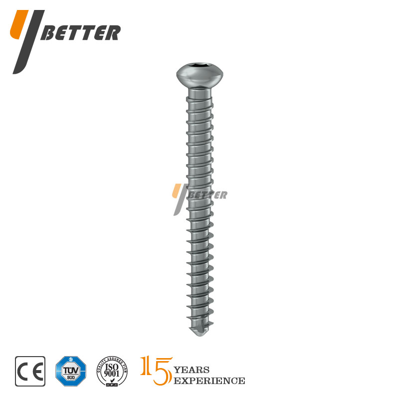 鎖定型脛骨髓內釘（近端鎖釘）