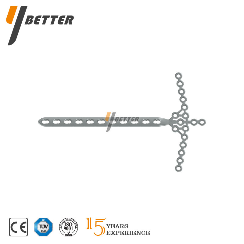 脛骨遠(yuǎn)端海鷗形鎖定板