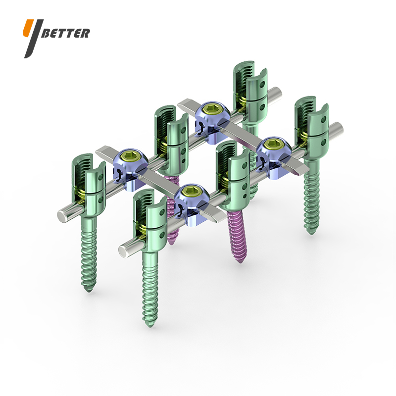 可折椎弓根釘I型