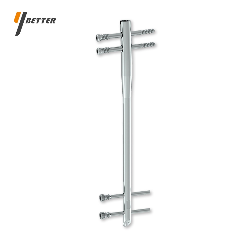 股骨倒置帶鎖髓內釘