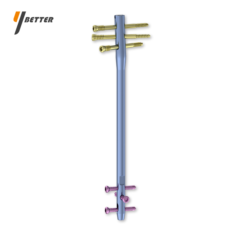 股骨倒打髓內釘