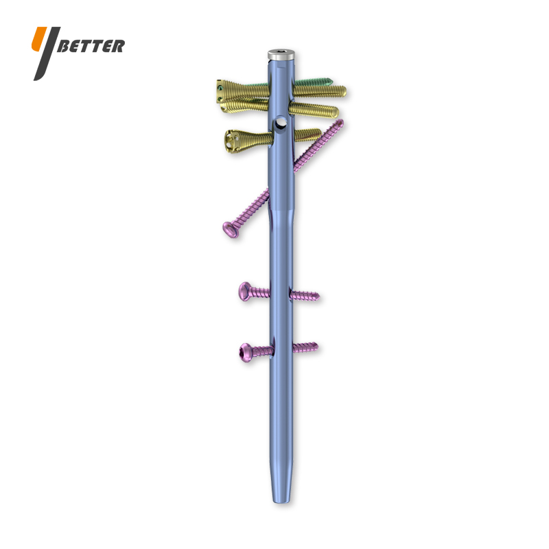 多維鎖定肱骨髓內釘