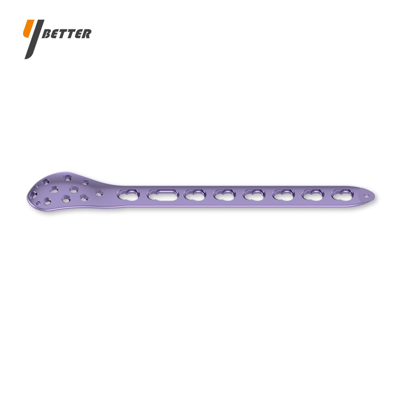 腓骨遠端前外側鎖定板B型