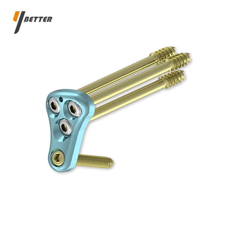 股骨近端鎖定板（萬向加壓）