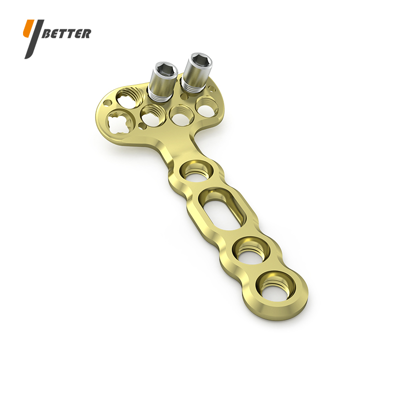 Y-DVR橈骨遠端掌側接骨板