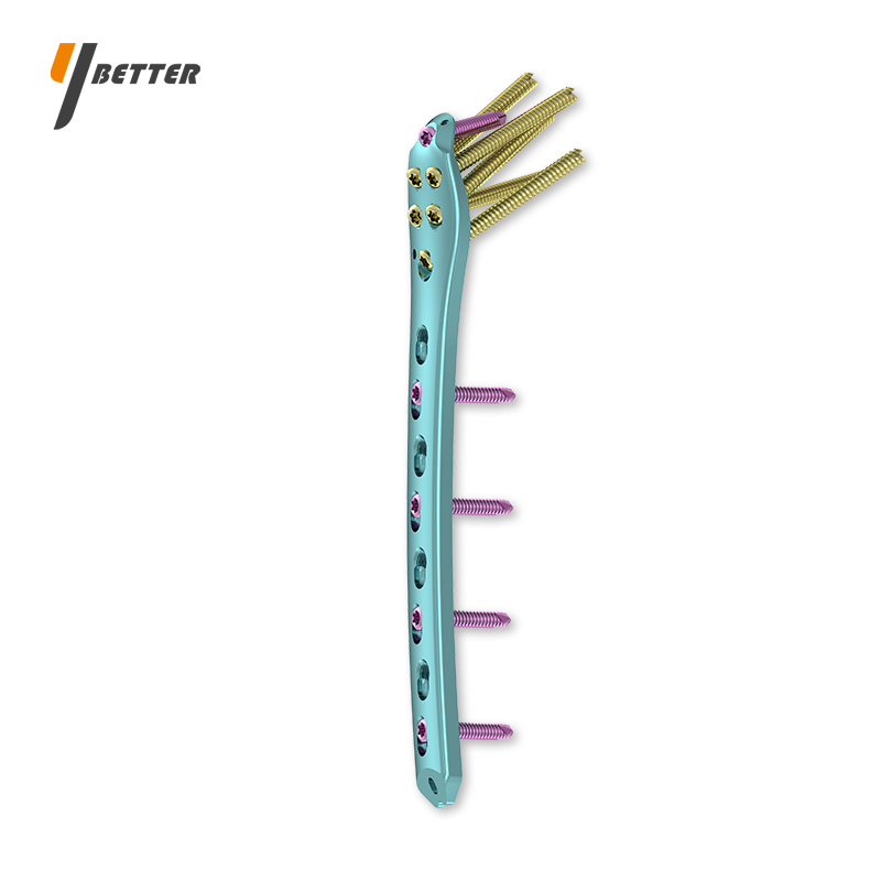 股骨近端解剖型鎖定板G型