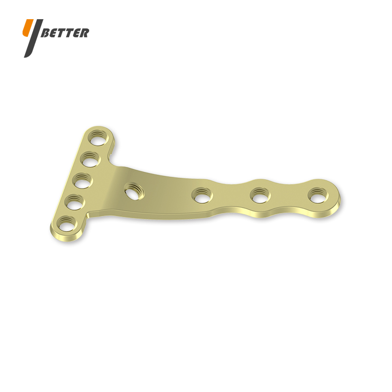 橈骨遠端掌側斜T形鎖定板