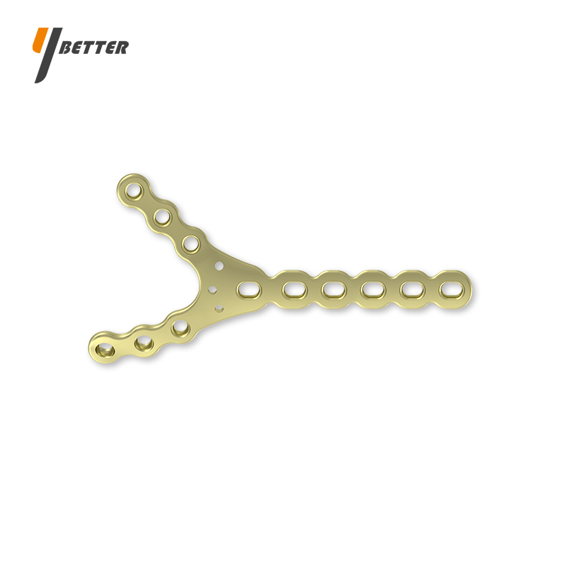 肱骨遠端Y形接骨板