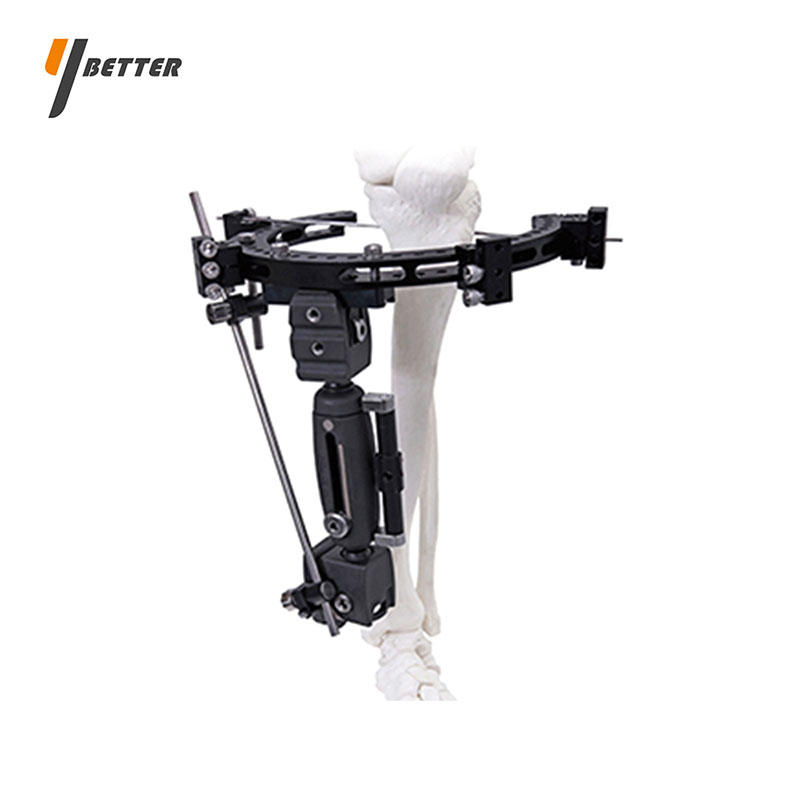 環形組合式支架（PEEK可透光）