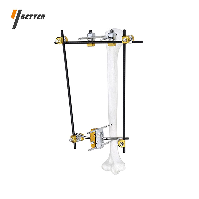 肱骨近端骨折固定支架