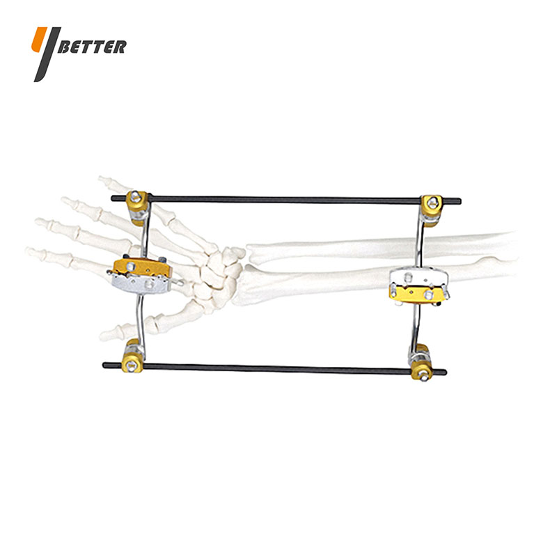 尺橈骨胯關節型支架