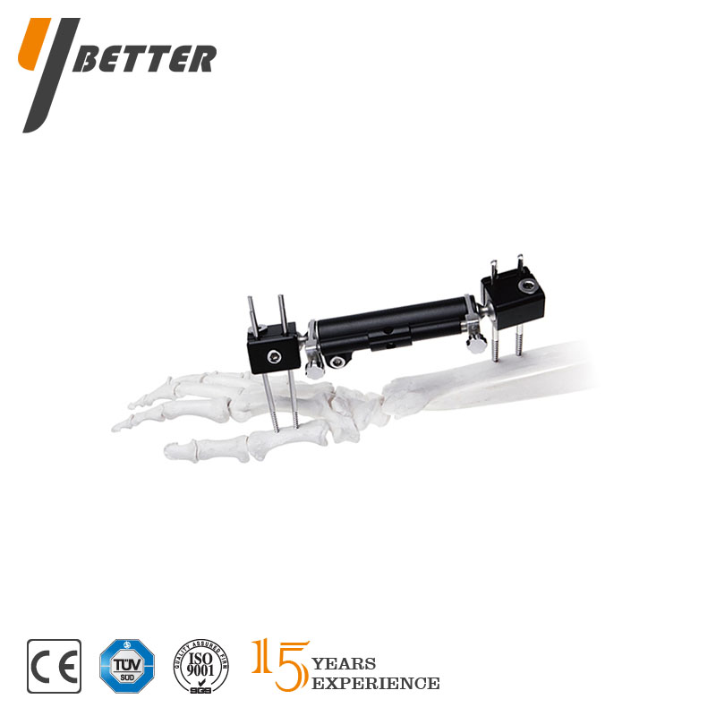 橈骨遠端可延長支架（PEEK可透光）