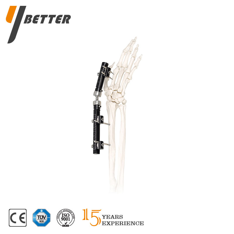 單側一體式外固定系統(tǒng)