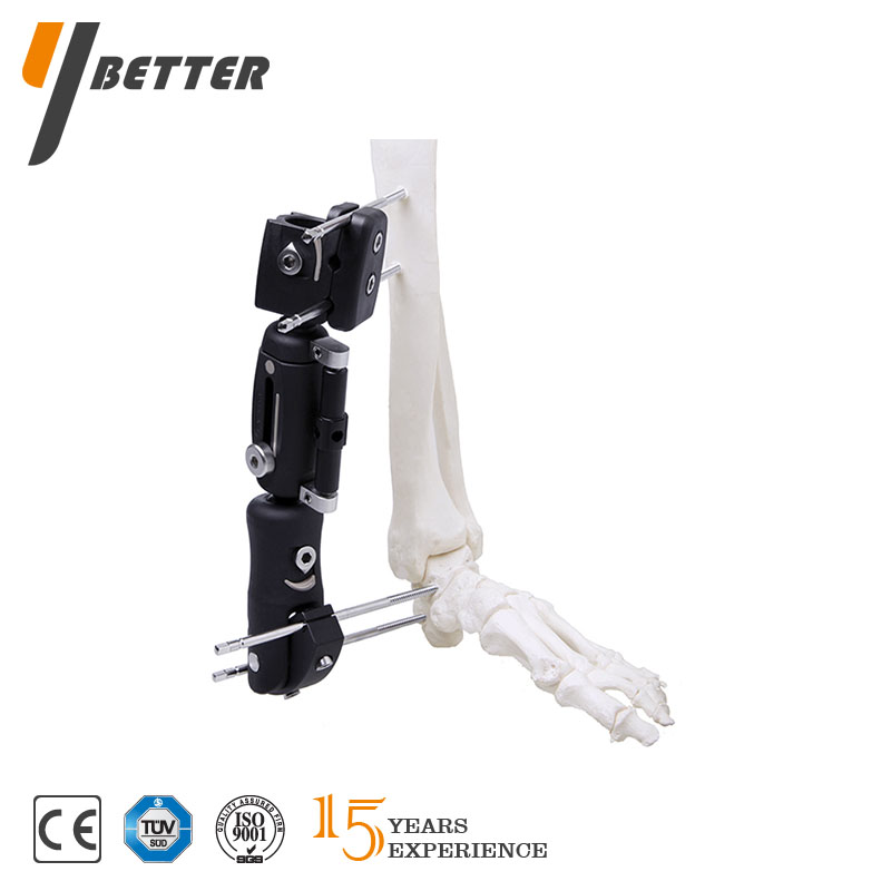 脛骨遠端支架（大號、小號）